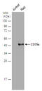 CD79a antibody, GTX131291, GeneTex, Western Blot image 