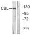 Cbl Proto-Oncogene antibody, LS-C117636, Lifespan Biosciences, Western Blot image 