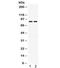 Phospholipase A2 Group IVA antibody, R32107, NSJ Bioreagents, Western Blot image 