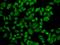 Aldehyde Dehydrogenase 2 Family Member antibody, GTX55502, GeneTex, Immunofluorescence image 