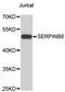 Serpin Family B Member 8 antibody, STJ111207, St John