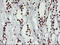 Glutathione S-Transferase Theta 2 (Gene/Pseudogene) antibody, LS-C172410, Lifespan Biosciences, Immunohistochemistry paraffin image 