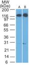 Cadherin 4 antibody, NBP2-27372, Novus Biologicals, Western Blot image 