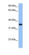 ADAM Metallopeptidase Domain 33 antibody, orb330601, Biorbyt, Western Blot image 