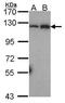 Nuclear Factor Kappa B Subunit 2 antibody, GTX101150, GeneTex, Western Blot image 