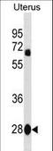 Vestigial Like Family Member 4 antibody, LS-C157032, Lifespan Biosciences, Western Blot image 
