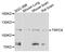 Transient Receptor Potential Cation Channel Subfamily C Member 6 antibody, A8155, ABclonal Technology, Western Blot image 