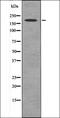 Platelet Derived Growth Factor Receptor Beta antibody, orb335848, Biorbyt, Western Blot image 