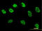 MutS Homolog 6 antibody, LS-C197374, Lifespan Biosciences, Immunofluorescence image 
