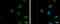 Serpin Family B Member 2 antibody, GTX103194, GeneTex, Immunocytochemistry image 