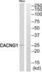 Calcium Voltage-Gated Channel Auxiliary Subunit Gamma 1 antibody, abx015001, Abbexa, Western Blot image 