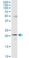 Sodium Channel Modifier 1 antibody, H00079005-M01, Novus Biologicals, Western Blot image 