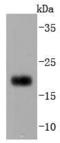 CD3d Molecule antibody, A04405-1, Boster Biological Technology, Western Blot image 