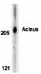 Apoptotic chromatin condensation inducer in the nucleus antibody, 2217, QED Bioscience, Western Blot image 