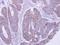 Lactamase Beta 2 antibody, GTX122755, GeneTex, Immunohistochemistry paraffin image 