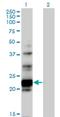 Nucleolar Protein 6 antibody, H00065083-B01P, Novus Biologicals, Western Blot image 