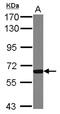 Glucokinase regulatory protein antibody, NBP2-16623, Novus Biologicals, Western Blot image 