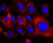 Platelet Derived Growth Factor Receptor Alpha antibody, NBP2-67025, Novus Biologicals, Immunocytochemistry image 