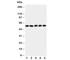 Hyaluronidase 2 antibody, R30915, NSJ Bioreagents, Western Blot image 