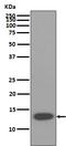 Beta-2-Microglobulin antibody, M00456-1, Boster Biological Technology, Western Blot image 