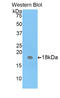 Carcinoembryonic Antigen Related Cell Adhesion Molecule 3 antibody, LS-C293175, Lifespan Biosciences, Western Blot image 