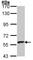 Dopamine Beta-Hydroxylase antibody, ab96615, Abcam, Western Blot image 