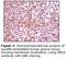 Synuclein Alpha antibody, LS-C47174, Lifespan Biosciences, Immunohistochemistry paraffin image 