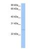 Ribosomal RNA-processing protein 7 homolog A antibody, NBP1-57551, Novus Biologicals, Western Blot image 