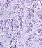 Human Papilloma Virus Type 16-E7  antibody, orb10573, Biorbyt, Immunohistochemistry paraffin image 