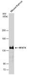 Nuclear Factor Of Activated T Cells 3 antibody, PA5-78403, Invitrogen Antibodies, Western Blot image 