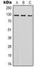 Sterol Regulatory Element Binding Transcription Factor 1 antibody, orb339012, Biorbyt, Western Blot image 