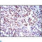 BMI1 Proto-Oncogene, Polycomb Ring Finger antibody, LS-C812513, Lifespan Biosciences, Immunohistochemistry paraffin image 