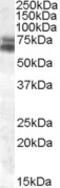 HCLS1 Associated Protein X-1 antibody, 46-927, ProSci, Western Blot image 