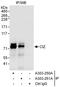 Zinc Finger Protein 384 antibody, A303-250A, Bethyl Labs, Immunoprecipitation image 