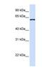 DDB1 And CUL4 Associated Factor 12 antibody, NBP1-56584, Novus Biologicals, Western Blot image 
