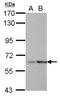 Leucine Rich Repeats And WD Repeat Domain Containing 1 antibody, NBP2-17176, Novus Biologicals, Western Blot image 