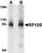 CD180 Molecule antibody, NBP1-76706, Novus Biologicals, Western Blot image 