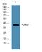 Purinergic Receptor P2X 1 antibody, A07497-1, Boster Biological Technology, Enzyme Linked Immunosorbent Assay image 