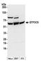 General Transcription Factor IIIC Subunit 5 antibody, NB100-60435, Novus Biologicals, Western Blot image 