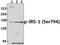 Insulin Receptor Substrate 1 antibody, A00268S794, Boster Biological Technology, Western Blot image 