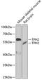 Tryptophan Hydroxylase 2 antibody, 22-739, ProSci, Western Blot image 