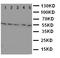 Hyaluronidase 2 antibody, LS-C312958, Lifespan Biosciences, Western Blot image 