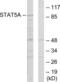 Signal Transducer And Activator Of Transcription 5A antibody, LS-C118892, Lifespan Biosciences, Western Blot image 