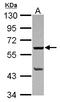 Phospholipase A2 Group IVF antibody, LS-C155627, Lifespan Biosciences, Western Blot image 