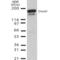 DNA Methyltransferase 1 antibody, M00172-1, Boster Biological Technology, Western Blot image 