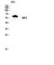 Receptor Interacting Serine/Threonine Kinase 2 antibody, STJ95512, St John
