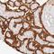 Tripartite Motif Containing 45 antibody, HPA030266, Atlas Antibodies, Immunohistochemistry frozen image 