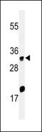 ELOVL Fatty Acid Elongase 5 antibody, LS-C167739, Lifespan Biosciences, Western Blot image 