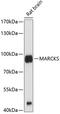 Myristoylated Alanine Rich Protein Kinase C Substrate antibody, 13-325, ProSci, Western Blot image 