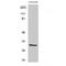 Abhydrolase Domain Containing 11 antibody, LS-C381849, Lifespan Biosciences, Western Blot image 
